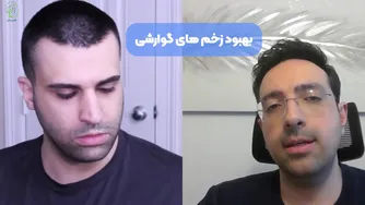 معجزه زردچوبه برای سلامت دستگاه گوارش