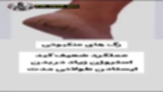 هشدار پاها