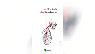 مواظب گردنت باش