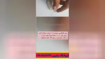 آموزش قالب‌ گیری لمینت متحرک دندان تورو اسمایل جنس اعلا
