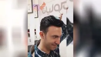 پروتز مو