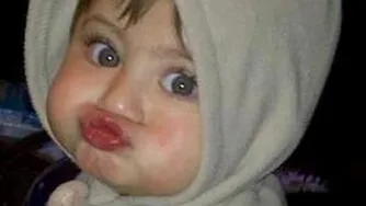 بوسه آتشین