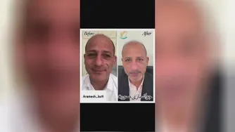 جوانسازی صورت در گوهردشت کرج