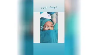 بهترین دکتر ابدومینوپلاستی