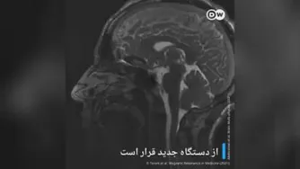 تپش مغز