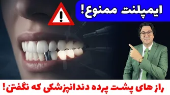 ایمپلنت دندان: حقایقی که قبل از تصمیم‌گیری باید بدانید — آیا برای شما مناسب است؟