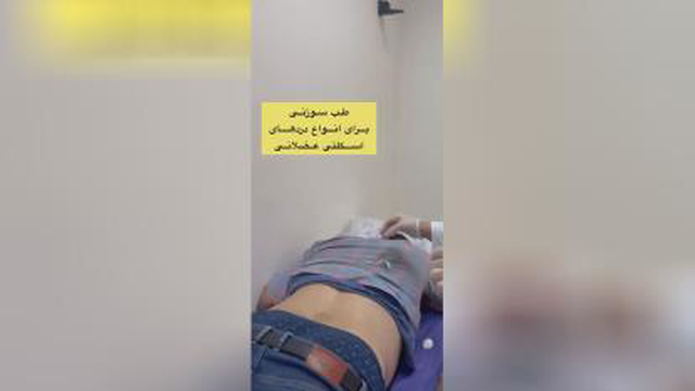 بهترین مرکز لاغری شهریار