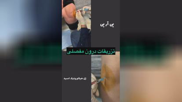 بهترین مرکز لاغری شهریار