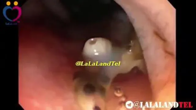 انگل
