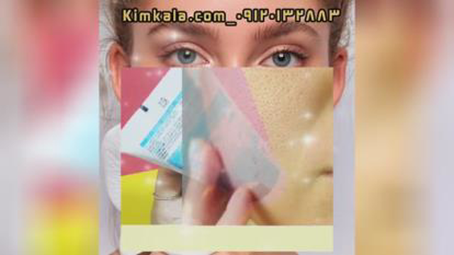بهترین لایه بردار قوی صورت09120132883