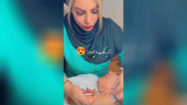 ژل و بوتاکس