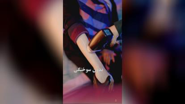 اموزش ژل و بوتاکس