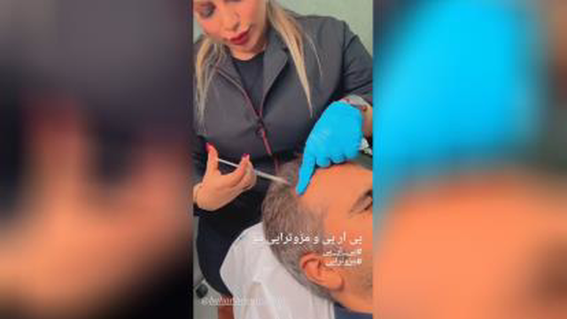 اموزش ژل و بوتاکس