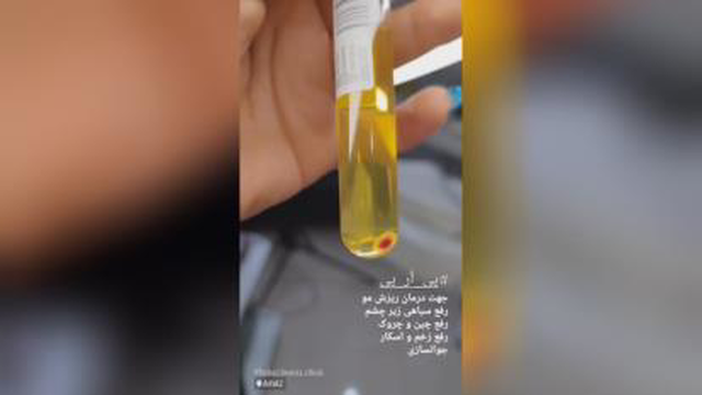 اموزش ژل و بوتاکس