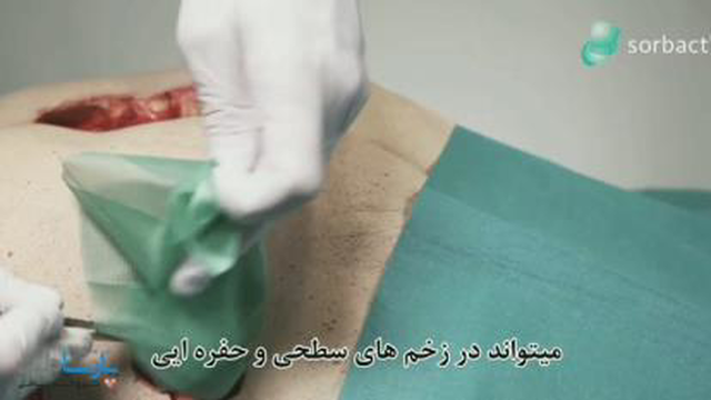 پانسمان کمپرس سوربکت