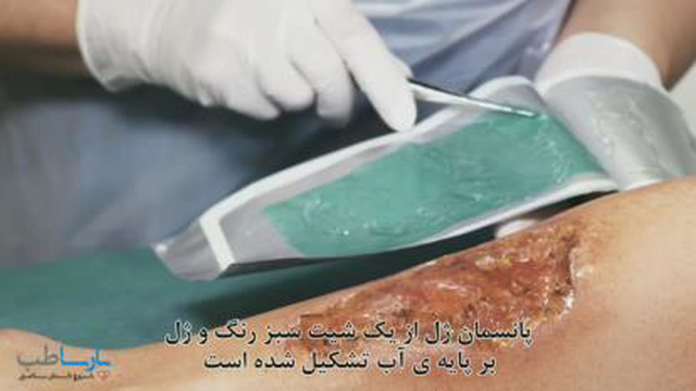 پانسمان ژل سوربکت