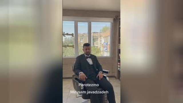 پروتز مو در تهران