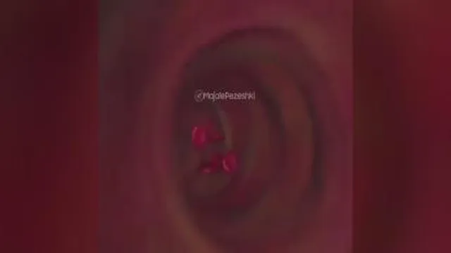 یا من اسمه دواء وذکره شفاء😘😘خواص هسته خرما 😇😇😇😇هرکی نبینه ضرر کرده 😋😋😋