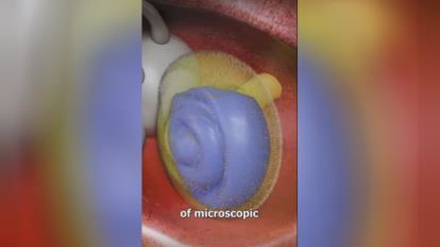 بهترین نمایندگی سمعک