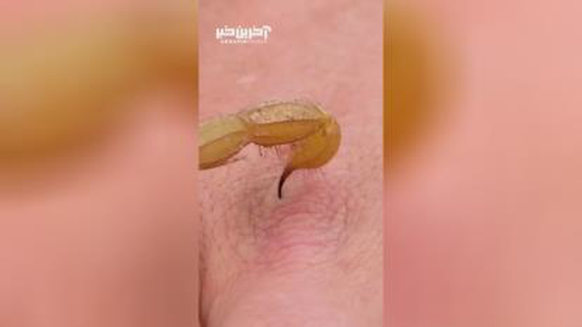 نیش عقرب