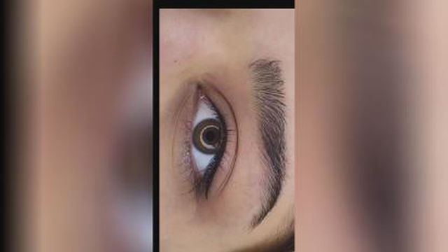 فیبروز