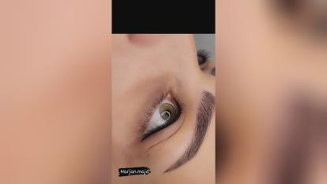 فیبروز