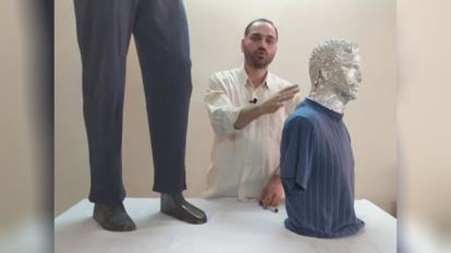 قسمت 4-شروع مباحث درمانی-سکته مغزی 1