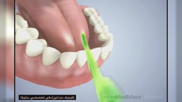 روش کشیدن نخ دندان 2