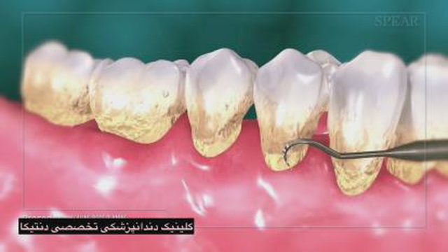 جرمگیری
