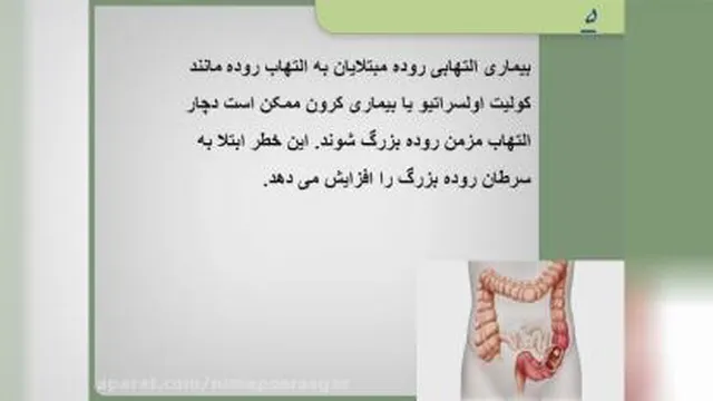 رسیدن فاکتور سرطان کولون