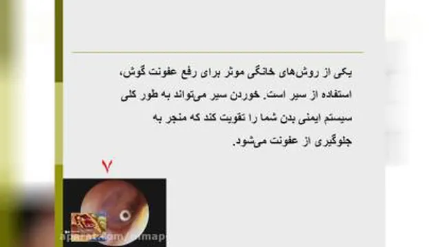 عفونت گوش