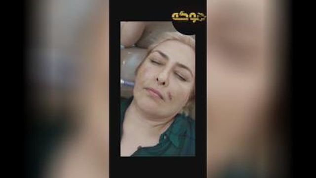 مزونیدلینگ در کرج
