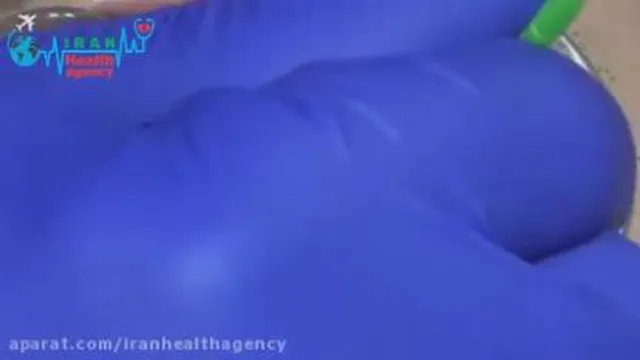 کامپوزیت