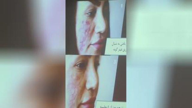 دهمین کنگره بین المللی زخم و ترمیم بافت