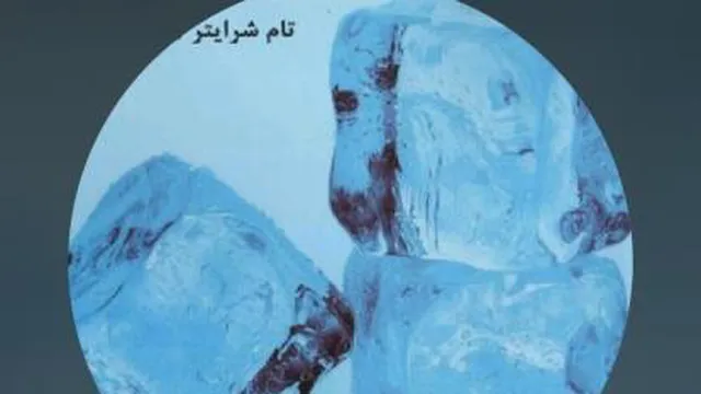 تام شرایتر-یخ شکن ها قسمت دوم