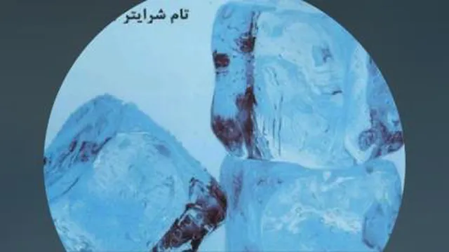 تام شرایتر-یخ شکن ها قسمت اول