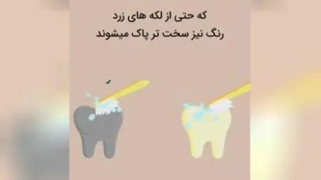 سلامتی دندان