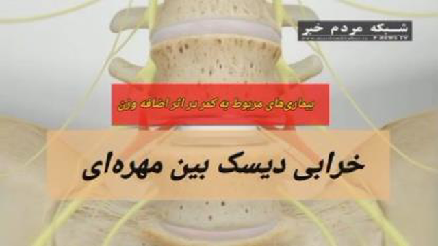 #اضافه وزن