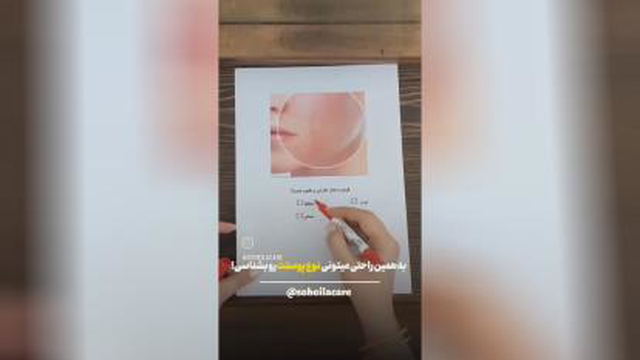 تشخیص جلد