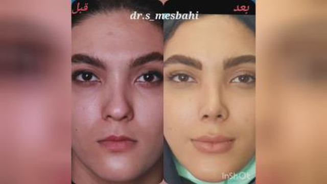 فوق تخصص جراحی پلاستیک و زیبایی درساری
