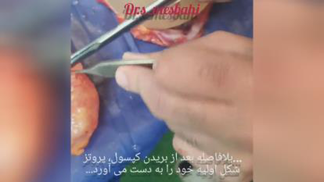بهترین جراح پلاستیک وزیبایی در ساری