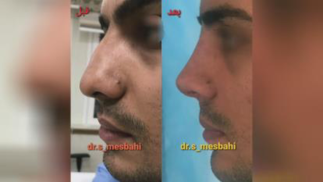 بهترین جراح پلاستیک وزیبایی در ساری