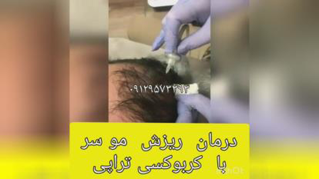مرکز تخصصی لیزر در ساری