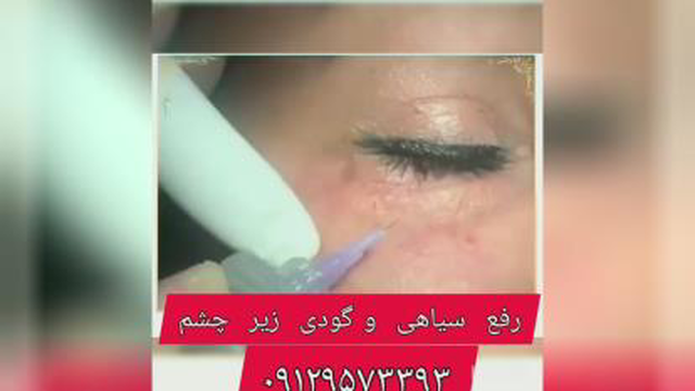 کلینیک تخصصی لیزر دوستی در ساری