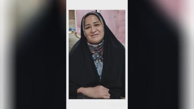 رفع تیرگی و لک صورت در علی آباد