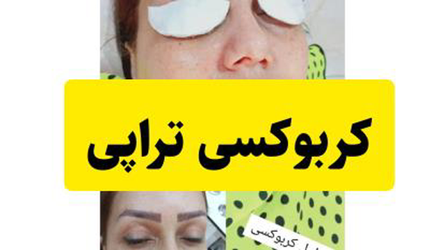 کربوکسی تراپی در علی آباد کتول-سمیه افشاری