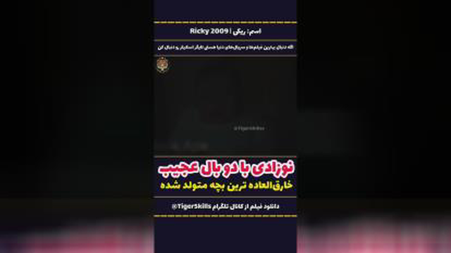 نوزادی بادوبال عجیب خارق العاده ترین بچه متولد شده