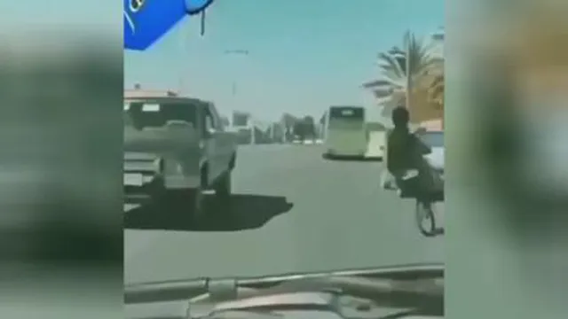 بعد دیدن این باید بریم کرم رشد پشم بخریم😱😱😐😂
