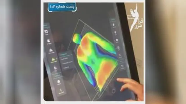 درمان قوز کمر