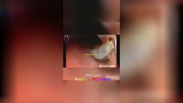 انگل فاسیولا دکترسهیل سریزدی